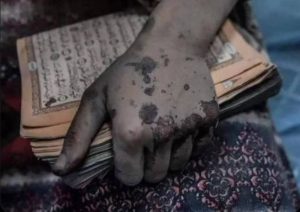 KONJIC: Nakon požara Kur’an ostao neoštećen u sobi zahvaćenoj vatrom